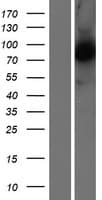 Human CAPN5 / Calpain 5 Protein (Over-Expression Lysate Myc-DDK (Flag))
