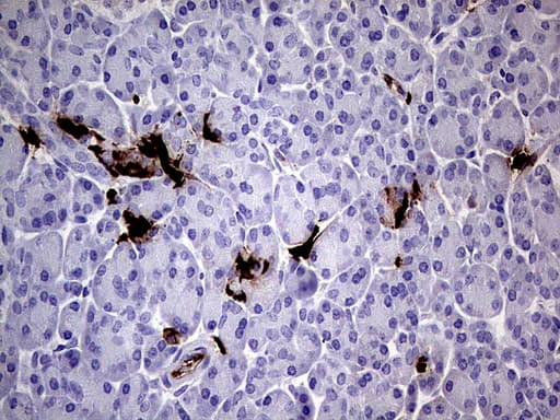 S100A9 / MRP14 Antibody (clone UMAB174, Carrier-free)