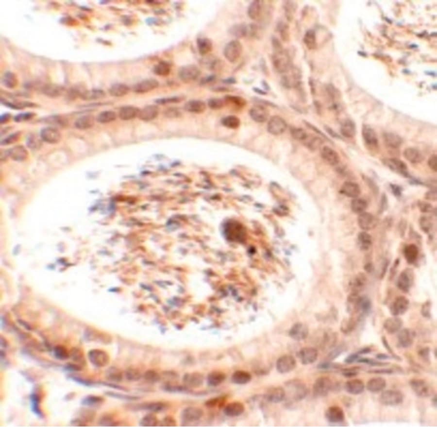 SPATA3 / ASARG1 Antibody