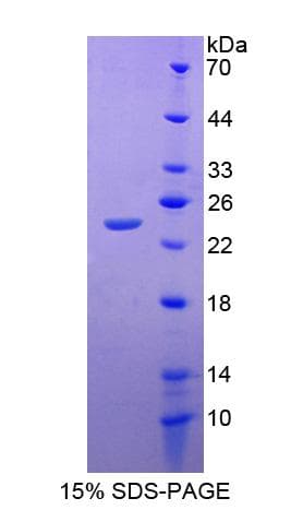 Human CUTA Protein (Recombinant His-S)