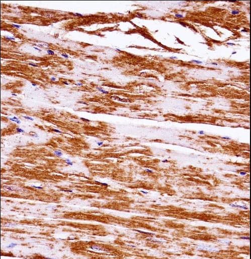MAP3K5 / ASK1 Antibody (aa1175-1203)