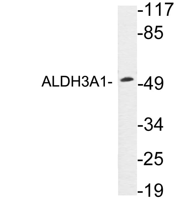 Polyclonal Rabbit anti-Human ALDH3A1 Antibody (aa236-285, WB)