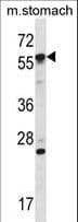 OXSR1 / OSR1 Antibody (aa94-121)