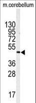 Polyclonal Rabbit anti-Human ITPKA Antibody (aa1-30, WB)