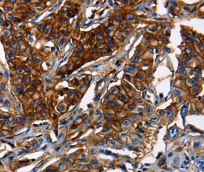ABCC5 / MRP5 Antibody