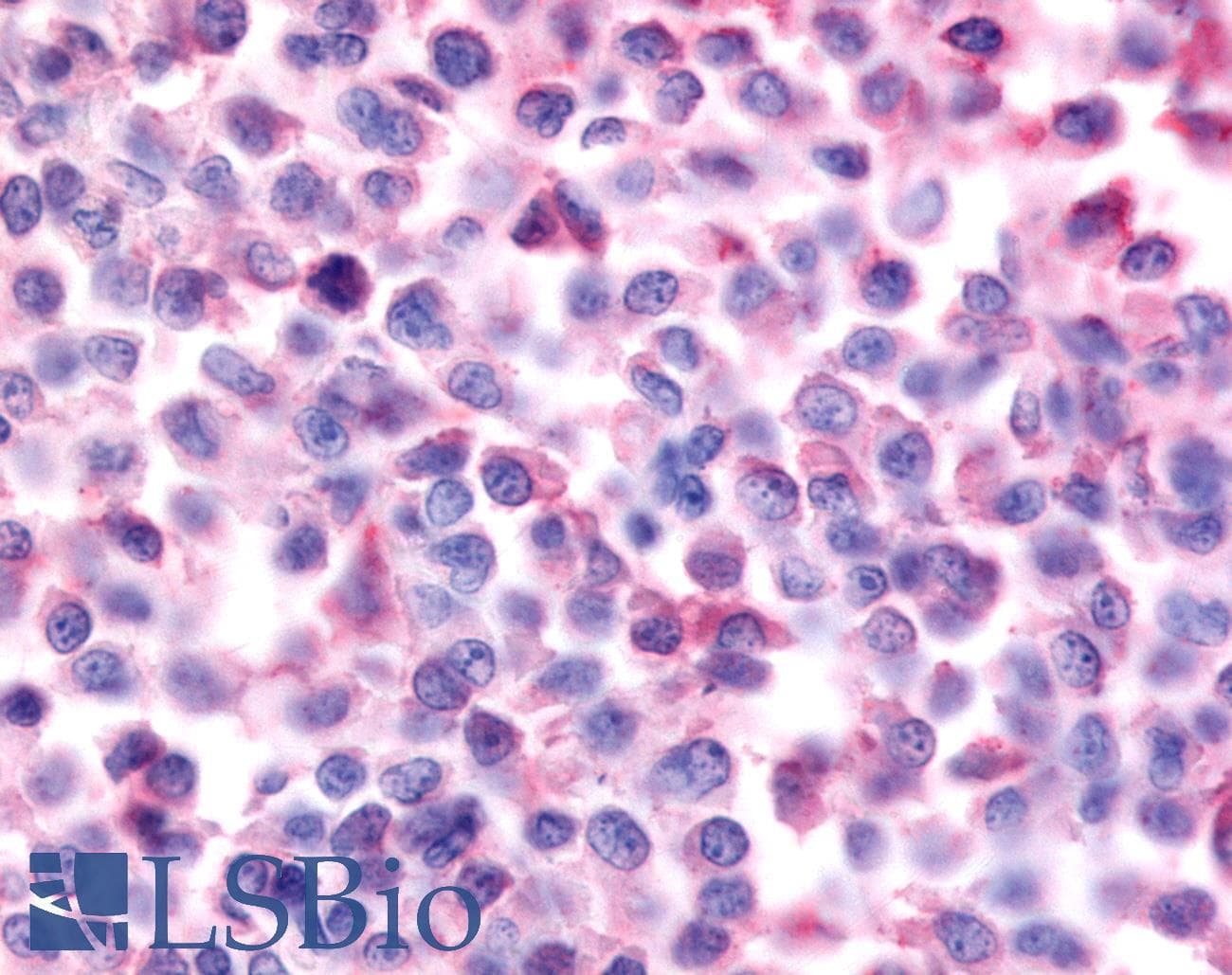 PathPlus™ NR5A2 / LRH-1 Antibody (Internal)