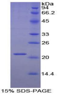 Rabbit TIMP1 Protein (Recombinant His)