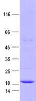 Human CTAG1B / NY-ESO-1 Protein (Recombinant DDK,C-terminus)