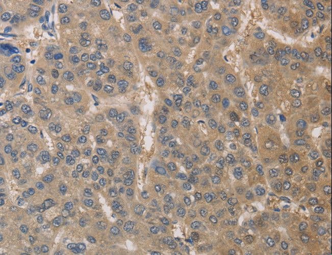 DPYSL3 / CRMP4 Antibody
