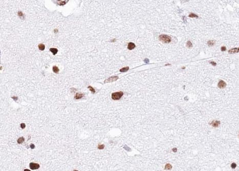 EZH1 / ENX-2 Antibody