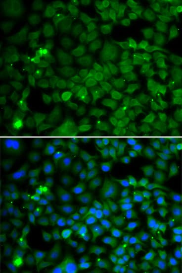 Polyclonal Rabbit anti-Human SMYD4 Antibody (IHC, IF, WB)