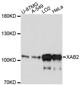 Polyclonal Rabbit anti-Human XAB2 Antibody (WB)