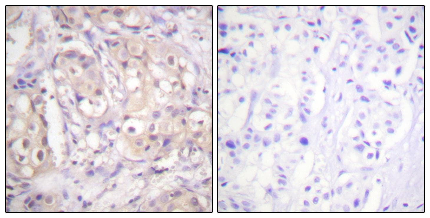 BRAF / B-Raf Antibody (phospho-Thr599)