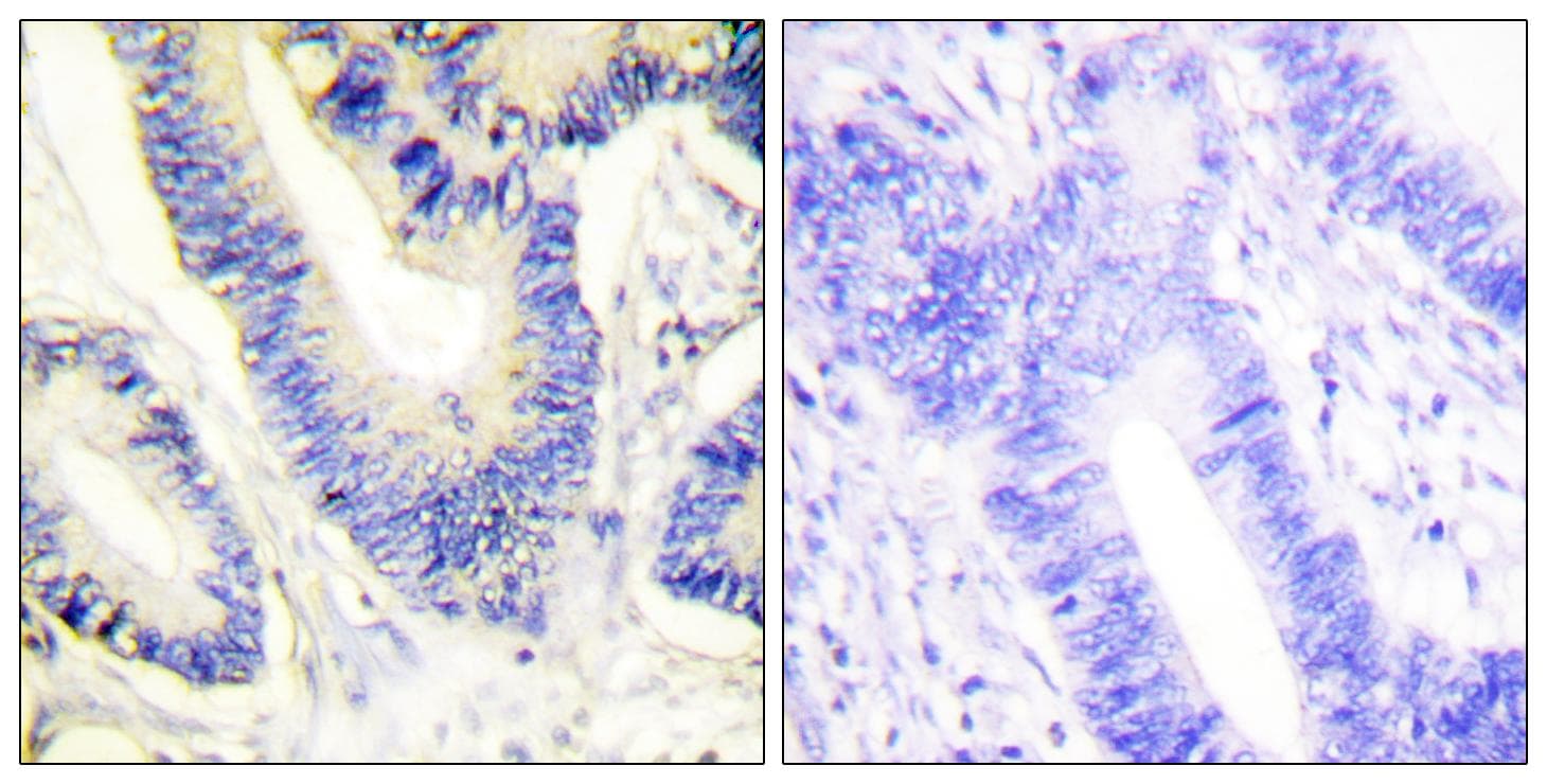 IRS1 Antibody (Ab-612)
