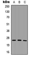 SCNM1 Antibody (Internal)