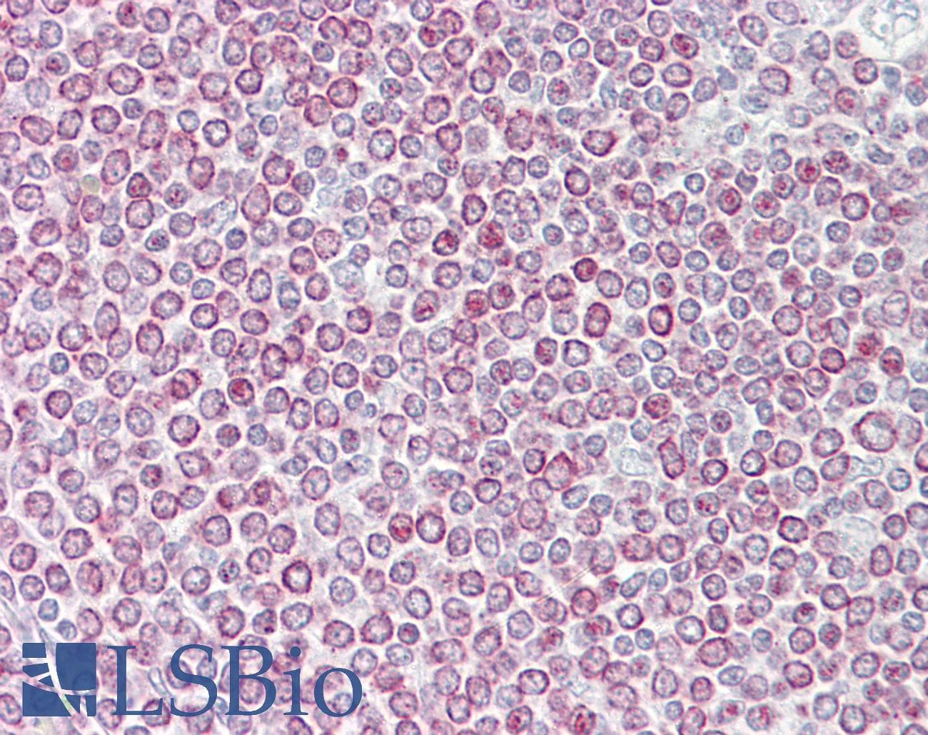 BRAK / CXCL14 Antibody (C-Terminus)