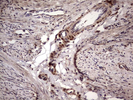 Monoclonal Mouse anti-Human BFSP2 Antibody (clone OTI4E7, aa184-415, IHC, WB)
