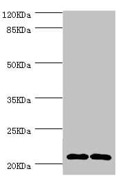 CMPK / CMPK1 Antibody