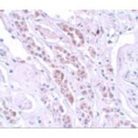Polyclonal Rabbit anti-Human TCTN1 Antibody (IHC, IF, WB)