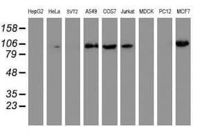 PFKP Antibody (clone OTI5F7)