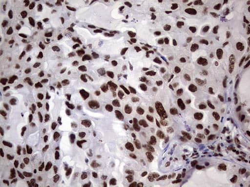 C14orf166 Antibody (clone OTI1B2)