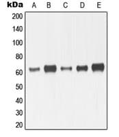MMP14 Antibody (C-Terminus)