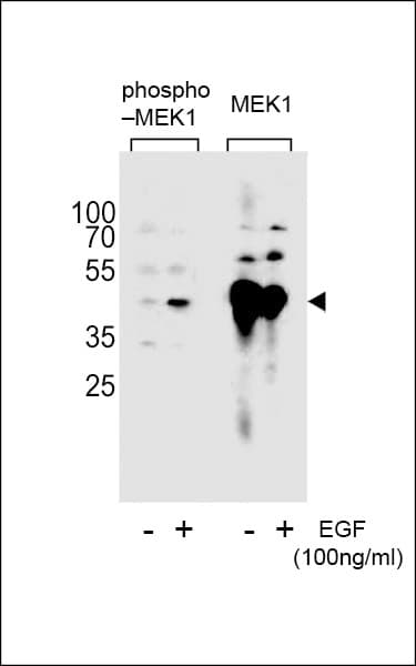 MAP2K1 / MKK1 / MEK1 Antibody (phospho-Ser222)