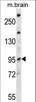 NEDD4L / NEDD4-2 Antibody (aa576-604)