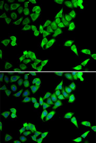TRIP10 / CIP4 Antibody