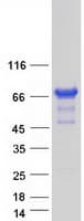 Human NOL4L Protein (Recombinant Myc-DDK (Flag))