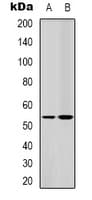 STK11 / LKB1 Antibody (Internal)
