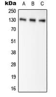 Polyclonal Rabbit anti-Human PC / Pyruvate Carboxylase Antibody (Internal, WB)