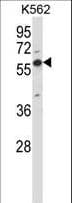OXSR1 / OSR1 Antibody (aa94-121)