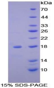 Mouse NDUFAB1 / ACP Protein (Recombinant His-T7)