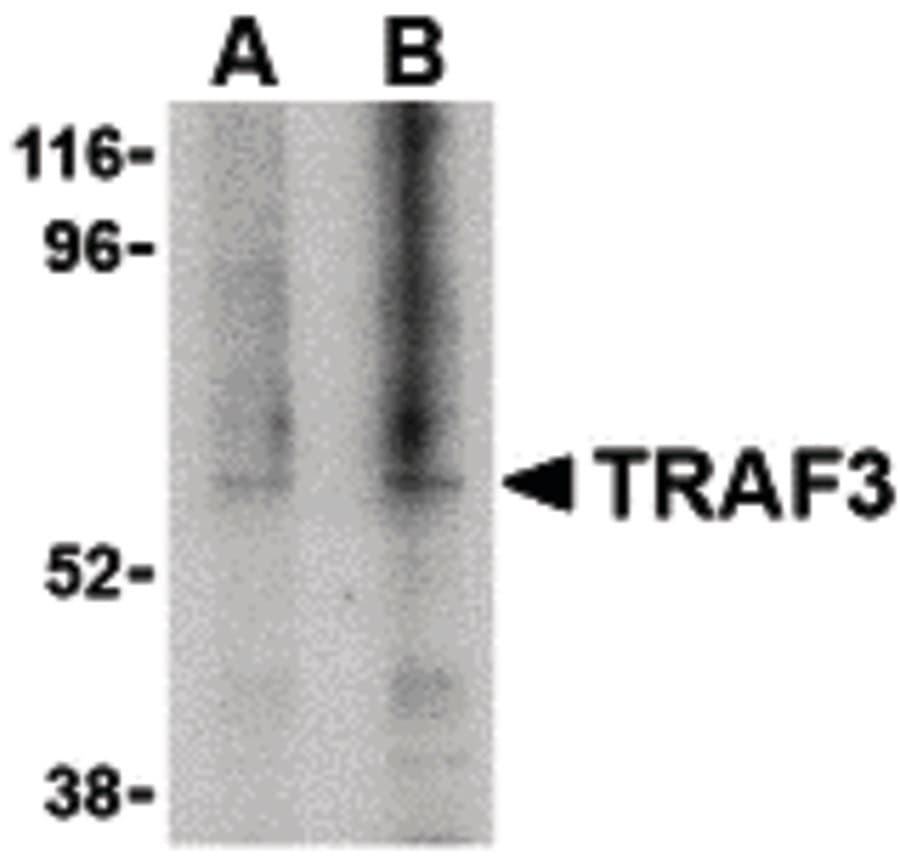 IHC-plus™ TRAF3 Antibody
