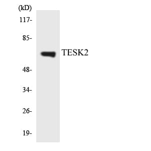 TESK2 Antibody (aa191-240)