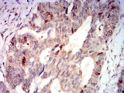 AURKA / Aurora-A Antibody (aa268-404, clone 2D8A4)