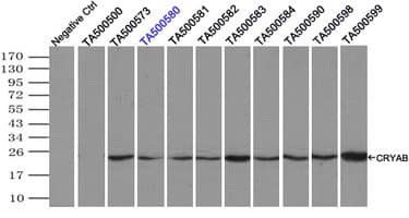 CRYAB / Alpha B Crystallin Antibody (clone OTI3E3, Carrier-free)