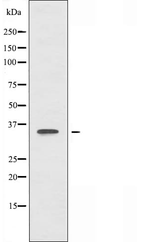 Polyclonal Rabbit anti-Human ACOT8 Antibody (IF, WB)