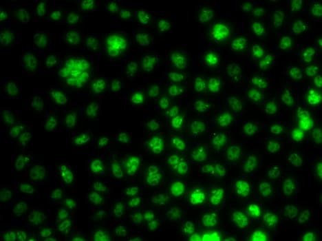 UBE2R2 Antibody