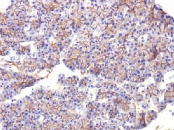 SPTBN2 Antibody (clone SPTBN2/1584)
