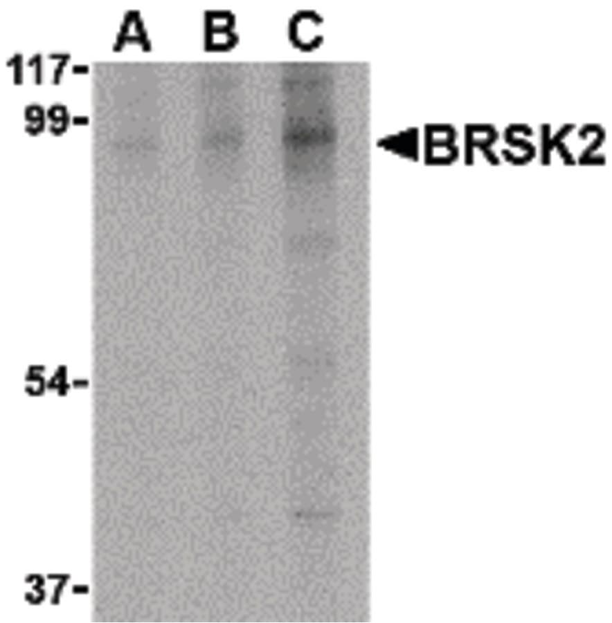 Polyclonal Rabbit anti-Human BRSK2 Antibody (IHC, IF, WB)