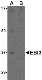Polyclonal Rabbit anti-Human EBI3 / IL-27B Antibody (IHC, IF, WB)
