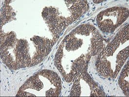 Monoclonal Mouse anti-Human UBE2J1 Antibody (clone OTI3C11, IHC, WB)