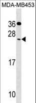 FSP27 / CIDEC Antibody (aa97-126)