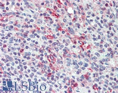 IHC-plus™ SLAMF7 / CRACC Antibody