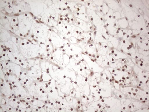 IRS1 Antibody (aa1-280, clone OTI9E11)