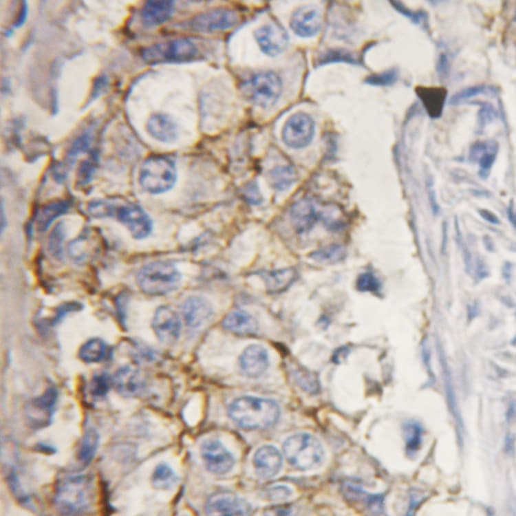 PRKCD / PKC-Delta Antibody (phospho-Tyr313)