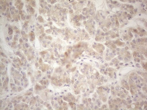 F12 / Factor XII Antibody (aa73-372, clone OTI1H5)