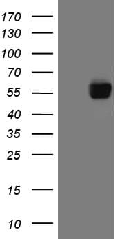 CD274 / B7-H1 / PD-L1 Antibody (aa19-290, clone OTI12G7)